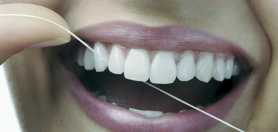Como a limpeza com fio dental pode clarear seus dentes