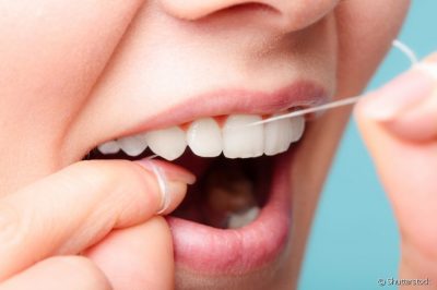 Como a limpeza com fio dental pode clarear seus dentes