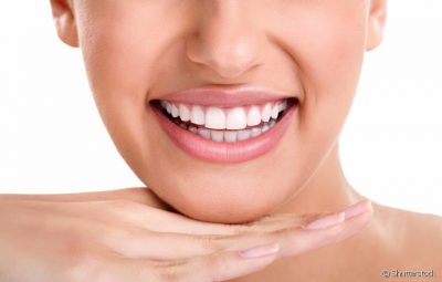 Como funciona o clareamento dental?