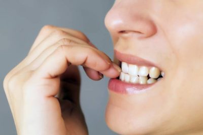 Roer unhas: mania que pode prejudicar sua saúde bucal